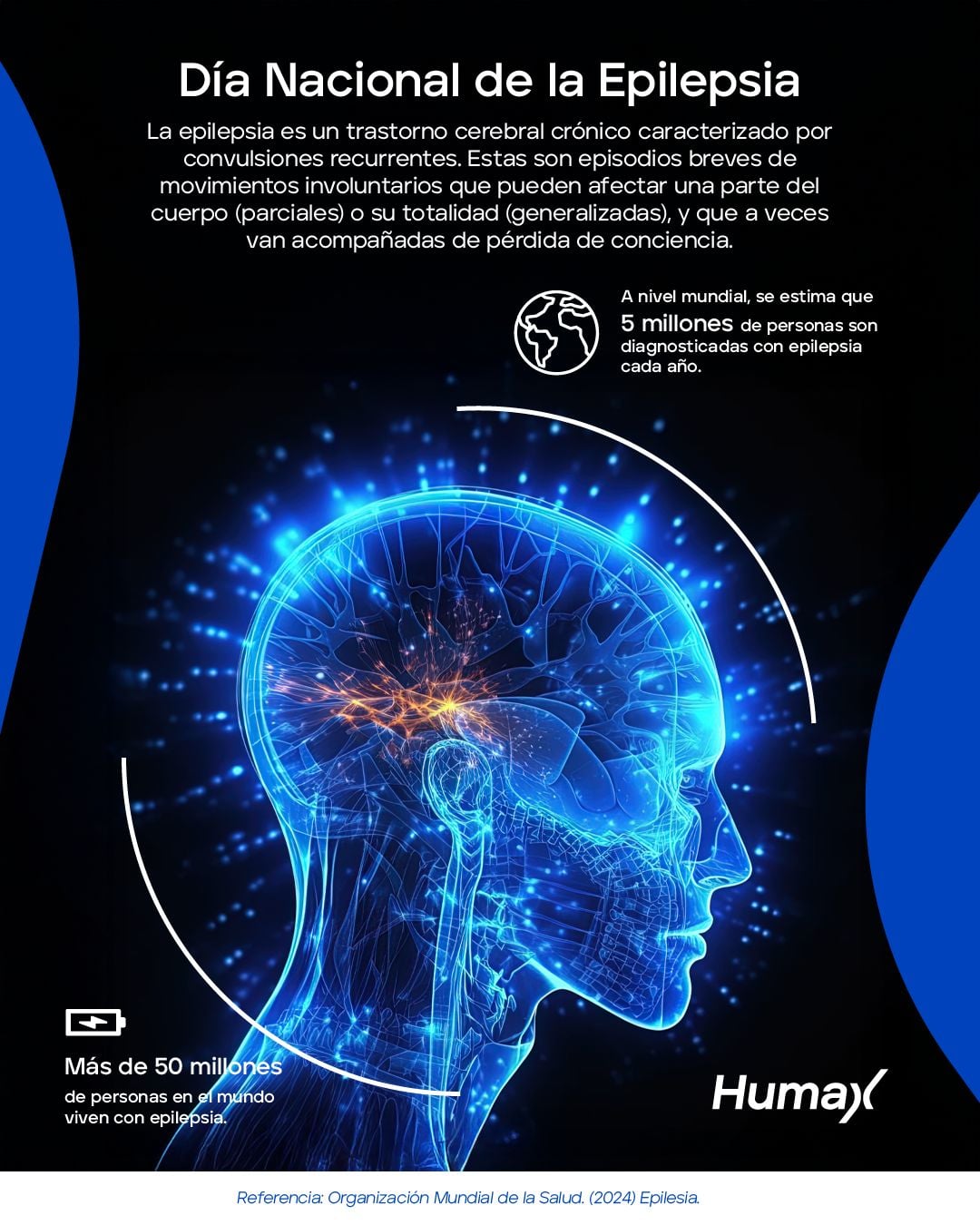 Infograf&iacute;a: Epilepsia