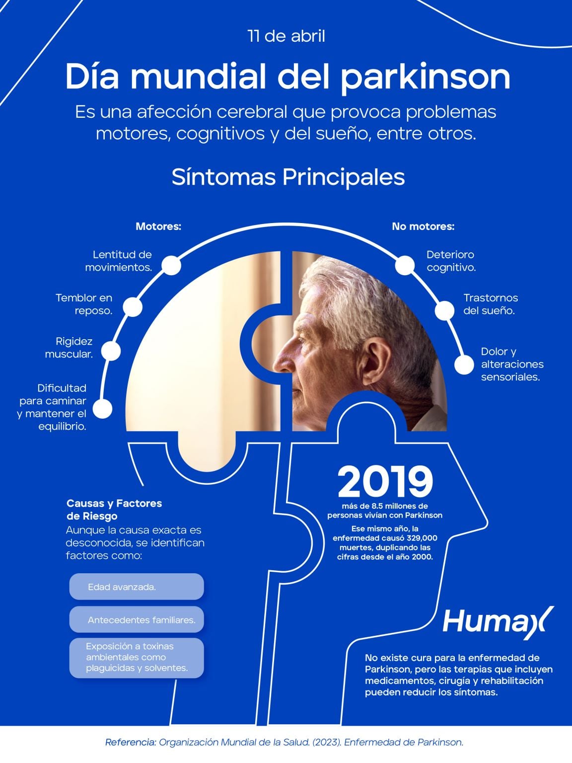 Infograf&iacute;a: Parkinson